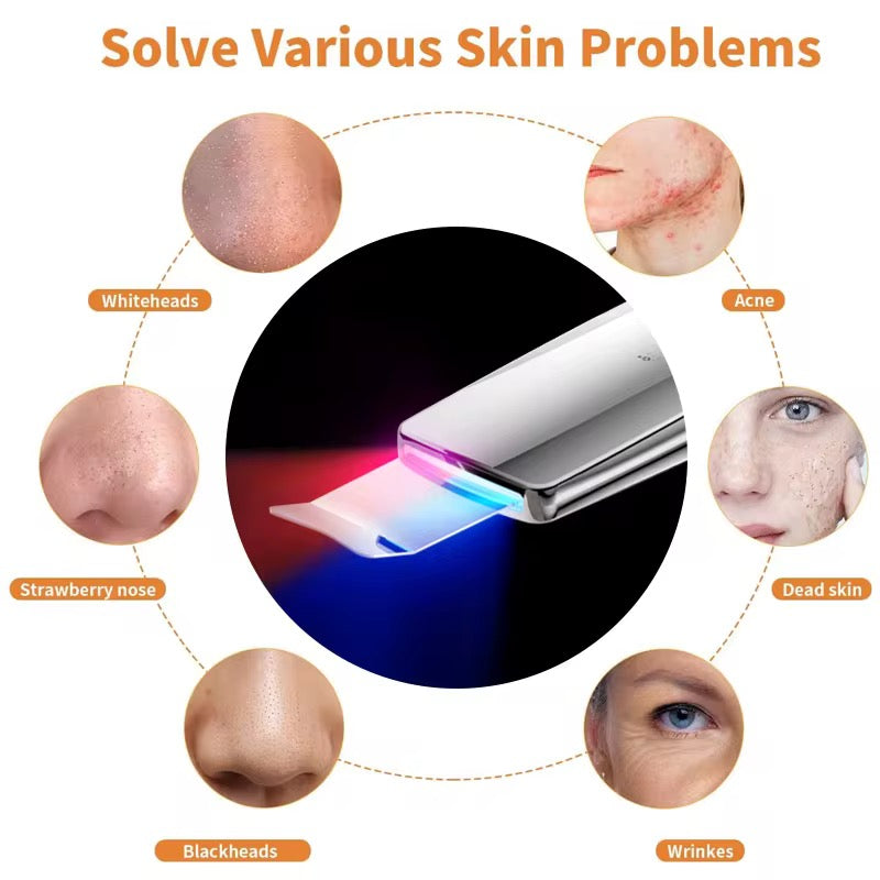 ✨ Ophéra™ Ultrasonic Skin Scrubber ✨